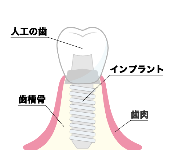 イラスト