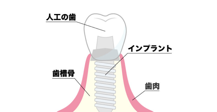 イラスト