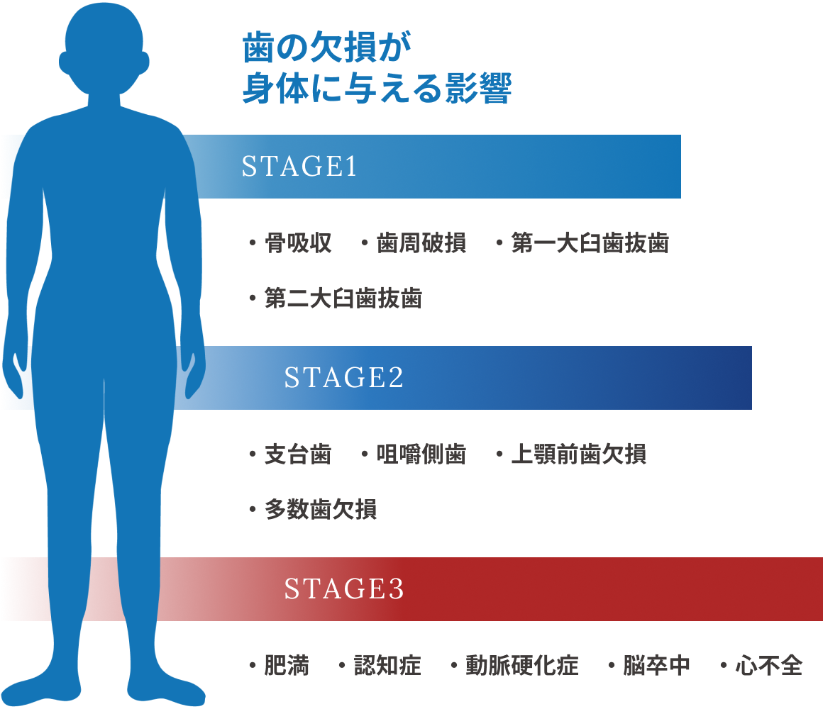 歯の欠損が身体に与える影響